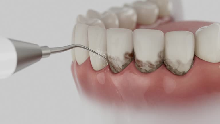 Reliable Dental contractor in Post, TX by Smile Center Dentistry